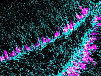 Región del cerebro donde se generan nuevas neuronas (azul) a lo largo de toda la vida. El estudio implica al gen Sox5 con la capacidad de neurogénesis en edad adulta