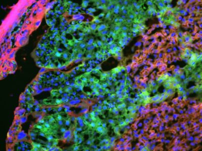 Imagen mostrando las células señalizadoras de la placenta de ratón (en verde) que son clave para el control remoto del metabolismo de la madre para apoyar el suplemento de nutrientes y crecimiento del feto. Imagen: Laboratorio de Sferruzzi-Perri.