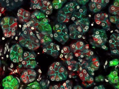 Imagen de microscopía de inmunofluorescencia de células de una glándula submandibular humana. La imagen revela que las células secretoras acinares, que se pensaba que eran todas iguales, en realidad son mucho más diversas, como lo demuestran las diferentes células de la misma glándula que expresan diferentes proteínas. En verde se indica la presencia de mucina 7 y en rojo se indica la presencia de amilasa. Los núcleos de células están en gris y la membrana epitelial en cian. Imagen: Alison May.