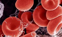 Los pacientes con hemofilia A grave (aproximadamente un 60% de los pacientes con la enfermedad) presentan niveles especialmente bajos de factor VIII, menos del 1% en la sangre, lo que lleva a que los episodios de sangrado sean más frecuentes y graves. Imagen: Science Photo Library, via Canva.