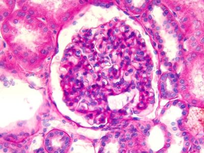 Los glomérulos del riñón son unas estructuras que filtrar las sustancias de la sangre. Imagen: Science Photo Library, vía Canva.