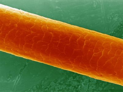 Estructura microscópica de un cabello humano. Imagen: David Gregory & Debbie Marshall.