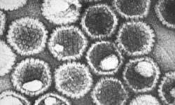 Viriones de virus del herpes observados a través de microscopía electrónica. Imagen: Centers for Disease Control and Prevention, Dr. Fred Murphy; Sylvia Whitfield.