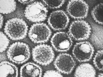 Viriones de virus del herpes observados a través de microscopía electrónica. Imagen: Centers for Disease Control and Prevention, Dr. Fred Murphy; Sylvia Whitfield.