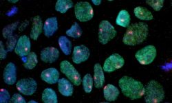 Células madre pluripotentes inducidas a partir de las células de la piel. Imagen: Laboratorio de Kathrin Plath, University of California, Los Angeles.