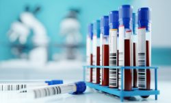 El nuevo biomarcador de Alzheimer podría identificar personas con la enfermedad en muestras de sangre, una aproximación más accesible para aplicaciones clínicas y de investigación. Imagen: Adobe Express.