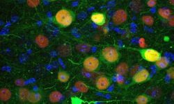 identifican un grupo de neuronas implicado en la regulación de la ansiedad