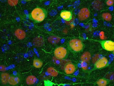 identifican un grupo de neuronas implicado en la regulación de la ansiedad