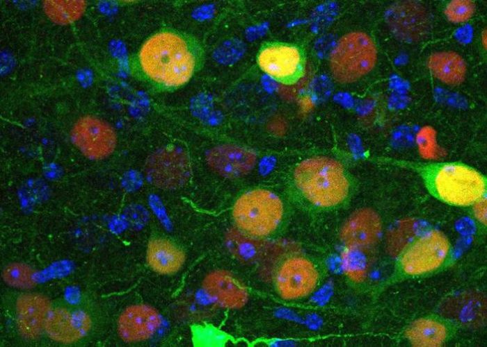 identifican un grupo de neuronas implicado en la regulación de la ansiedad