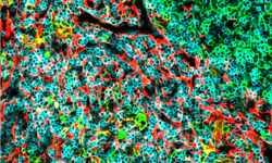 Imagen del microambiente del timo, donde se inicia la leucemia linfoblástica aguda de células T, analizado por inmunofluorescencia de detección múltiple. Una investigación ha identificado un grupo de microARNs relacionados con el desarrollo de los linfocitos T.