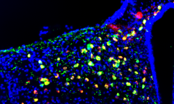 Imagen de microscopía de fluorescencia del núcleo arcuado del hipotálamo donde se aprecian, en color verde, las neuronas POMC. Imagen Alicia G Gómez-Valadés, IRB Barcelona.