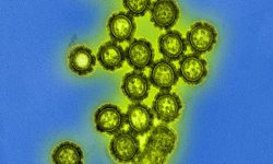 Partículas del virus de la gripe. Imagen: National Institute of Allergy and Infectious Diseases.