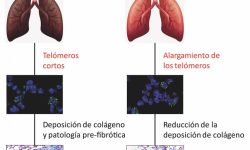 Infografía sobre los efectos de los telómeros cortos en el desarrollo de la fibrosis pulmonar asociada al envejecimiento en ratones control y ratones tratados con una terapia génica dirigida a alargar los telómeros. Imagen: CNIO.
