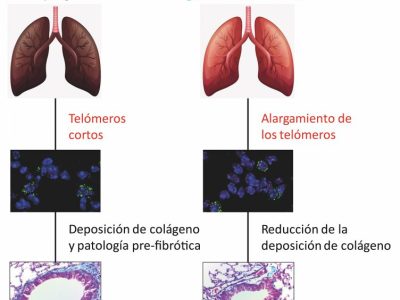 Infografía sobre los efectos de los telómeros cortos en el desarrollo de la fibrosis pulmonar asociada al envejecimiento en ratones control y ratones tratados con una terapia génica dirigida a alargar los telómeros. Imagen: CNIO.