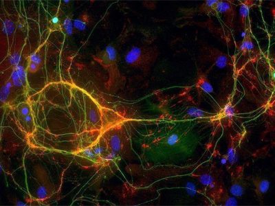 interneuron nih image gallery