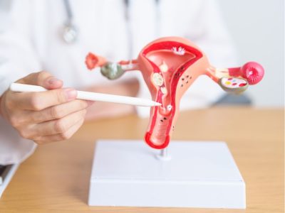 la edad de inicio de la menopausia, que marca el inicio del fin de la fertilidad está influida por la variación genética. Un reciente estudio ha encontrado una variante genética relacionada.