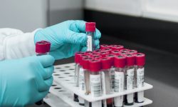 Un nuevo test desarollado por investigadores de xxx permite identificar en muestras de sangre dos tipos de mutaciones asociadas a la aparición de gliomas. Imagen: Fernando Zhiminaicela, Pixabay.