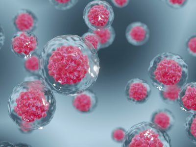 Las terapias CAR-T in vivo podrían utilizarse en más enfermedades y pacientes.