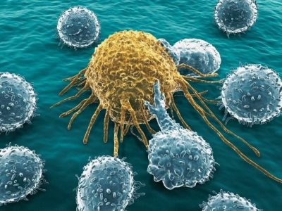 Ilustración artística de linfocito atacando a una célula tumoral. Imagen: canva