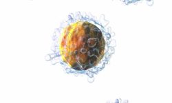 La Leucemia Linfoblástica aguda de células T (LLA-T) constituye el 15% de los casos de LLA.
Imagen: Linfocitos T (derivada de Blausen.com staff (2014). "Medical gallery of Blausen Medical 2014". WikiJournal of Medicine 1 (2). DOI:10.15347/wjm/2014.010. ISSN 2002-4436. - Own work, CC BY 3.0).