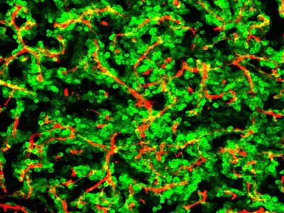 Células cancerosas invadiendo un cerebro de ratón, con los vasos sanguíneos en color rojo. /Manuel Valiente. CNIO