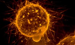 Las células que intervienen en la metástasis desarrollan ventajas que permiten su avance y propagación. Imagen: Formación de microtentáculos en una célula tumoral. Imagen: Stuart S. Martin, National Cancer Institute \ Univ. of Maryland Greenebaum Cancer Center.