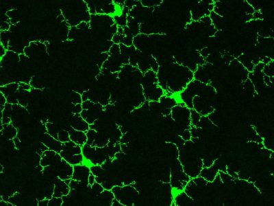 TREM2 interviene en la activación, supervivencia y función de las células inmunitarias del sistema nervioso central: la microglía. Imagen: Way T Wong, National Eye Institute, National Institute of Health.