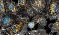 Además del ADN nuclear cada una de nuestras células contiene miles de copias de ADN mitocondrial localizadas en el interior de las mitocondrias. Imagen: Torsten Wittmann, University of San Francisco, CC BY NC 2.0 https://creativecommons.org/licenses/by-nc/2.0/.