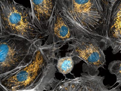 Además del ADN nuclear cada una de nuestras células contiene miles de copias de ADN mitocondrial localizadas en el interior de las mitocondrias. Imagen: Torsten Wittmann, University of San Francisco, CC BY NC 2.0 https://creativecommons.org/licenses/by-nc/2.0/.