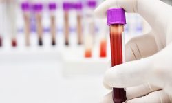 Desarrollan un prototipo de test diagnóstico para detectar el cáncer de páncreas en minutos con una muestra de sangre