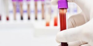 Desarrollan un prototipo de test diagnóstico para detectar el cáncer de páncreas en minutos con una muestra de sangre