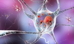 La ELA es una enfermedad neurodegenerativa que afecta a las neuronas del sistema nervioso central y que está caracterizada por una debilidad muscular progresiva.  Imagen: Science Photo Library, via Canva.