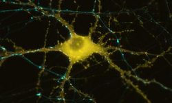 La enfermedad de Parkinson se caracteriza por la disminución de neuronas dopaminérgicas en el mesencéfalo. Imagen: Neurona UC San Diego School of Medicine.