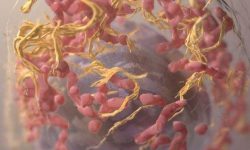 Las células tumorales del melanoma se caracterizan por la presencia de múltiples mutaciones, no sólo en genes que afectan al crecimiento o proliferación sino también en otros que pueden llevar a la formación de neoantígenos. Imagen: Reconstrucción en 3D de una célula de melanoma. Sriram Subramaniam, National Cancer Institute.