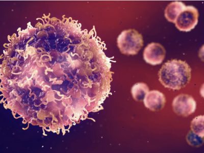 La inhibición de NGFR reduce la metástasis del melanoma. Imagen: Adobe Express.
