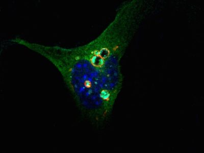 Células de ratón con proteína DOR. Imagen: (M. Romero, IRB Barcelona).