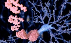 mayores niveles de proteina amiloide en personas con herencia materna de alzheimer