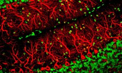 Células de Purkinje, principales células afectadas en la ataxia espinocerebelosa de tipo 2. Imagen: Yinghua Ma and Timothy Vartanian, Cornell University, Ithaca, N.Y. CC BY NC 2.0 https://creativecommons.org/licenses/by-nc/2.0/.