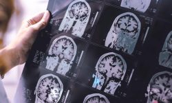 qué es la neurogenética