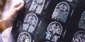 qué es la neurogenética