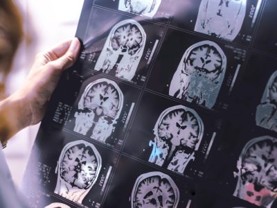 qué es la neurogenética