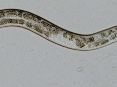 recurso-geneticamedicanews-laurafontrodonab