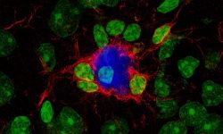 La microglía (rojo) responde al tratamiento reduciendo las placas amiloideas (azul) características del alzhéimer y protegiendo a las neuronas. Los núcleos celulares se muestran en verde. Imagen: IN (CSIC-UMH).
