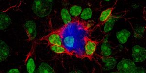 La microglía (rojo) responde al tratamiento reduciendo las placas amiloideas (azul) características del alzhéimer y protegiendo a las neuronas. Los núcleos celulares se muestran en verde. Imagen: IN (CSIC-UMH).