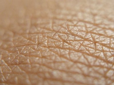 La piel humana constituye la primera barrera de protección de gran parte de nuestro organismo. Imagen: Pixabay.