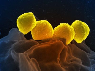 Bacteria del género Streptococcus. Imagen: National Institute of Allergy and Infectuous Diseases, EEUU)