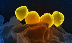 Bacteria del género Streptococcus. Imagen: National Institute of Allergy and Infectuous Diseases, EEUU)