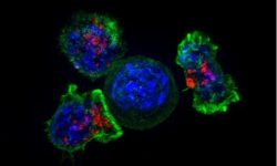 Linfocitos T killer atacando una célula tumoral. Imagen: Alex Ritter, Jennifer Lippincott Schwartz and Gillian Griffiths, National Institutes of Health.