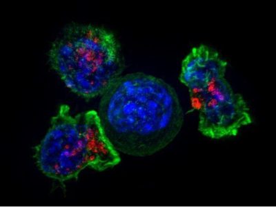 Linfocitos T killer atacando una célula tumoral. Imagen: Alex Ritter, Jennifer Lippincott Schwartz and Gillian Griffiths, National Institutes of Health.