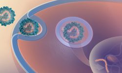 tratamiento epidermólisis bullosa
